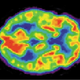 Image for article titled Six Ways Science Can See Into Your Brain